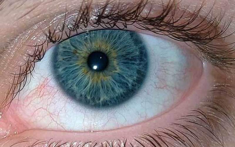 آبی رنگ شدن سفیدی چشم کودک نشانه چیست؟