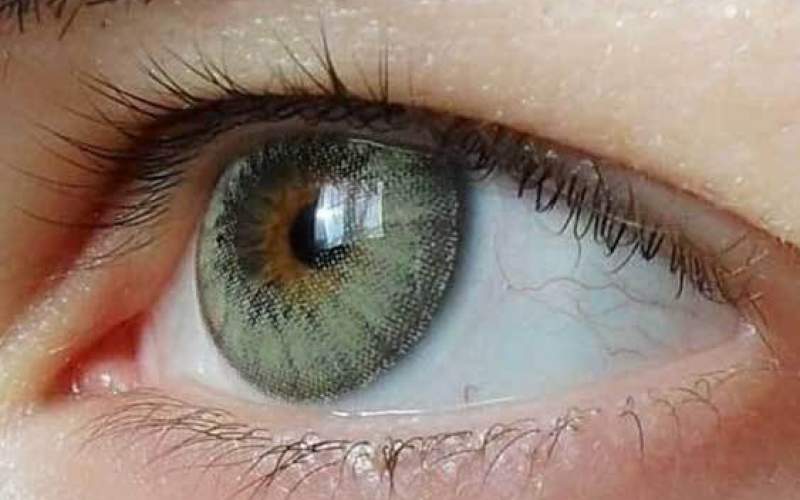 خطراتی که لنز‌های چشمی را تهدید می‌کنند