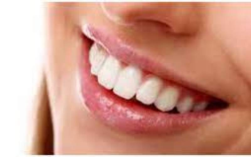 با این ۵ اشتباه رایج دندان‌هایتان زرد می‌شود