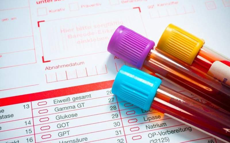 نتیجه آزمایش خون شما به چه معناست؟