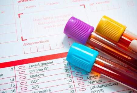 نتیجه آزمایش خون شما به چه معناست؟