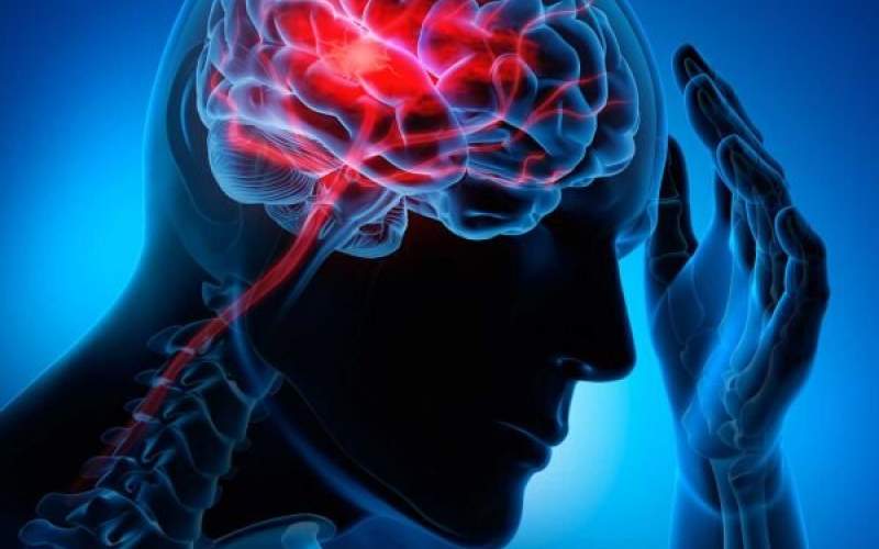 چگونه می‌توان از سکته مغزی جلوگیری کرد؟