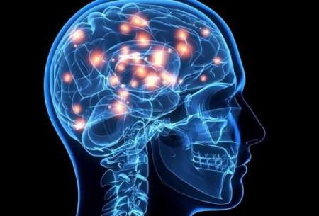 تجمع آهن در مغز پس از ضربه مغزی