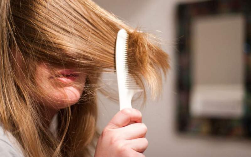 چه عواملی در ریزش مو دخیل هستند؟