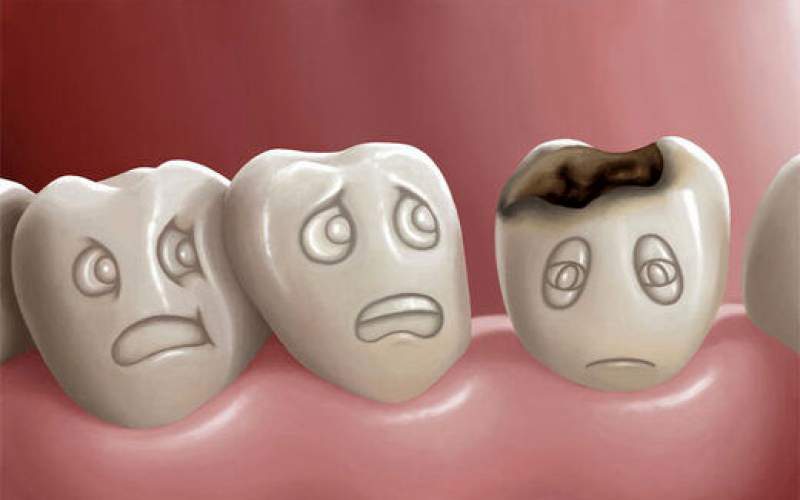 ۵ خوراکی که سلامت دندان را تهدید می‌کند
