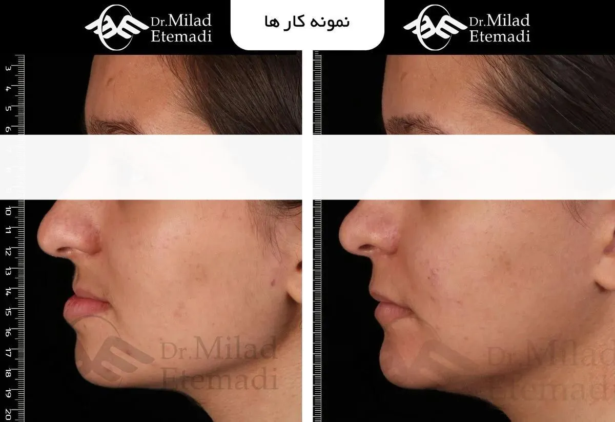 جراحی فک در اصفهان 