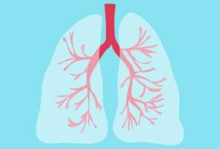 پیشنهادهای تغذیه‌ای برای بیماران مبتلا به آسم