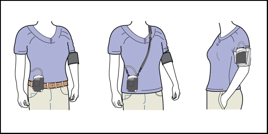 آشنایی با دستگاه هولتر فشار خون
