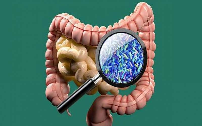 دلیل بیماری آرتریت روماتوئید چیست؟