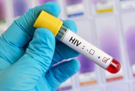 HIV؛ بیماری عفونی و قابل کنترل