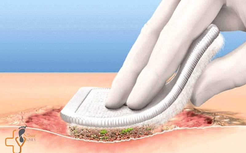 درمان زخم ناشی از دیابت