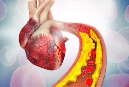 کلسترول خون را چه‌طور کاهش دهیم؟