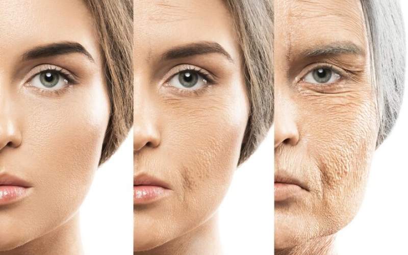 پیشگیری از چین و چروک پوست و سفیدی موها