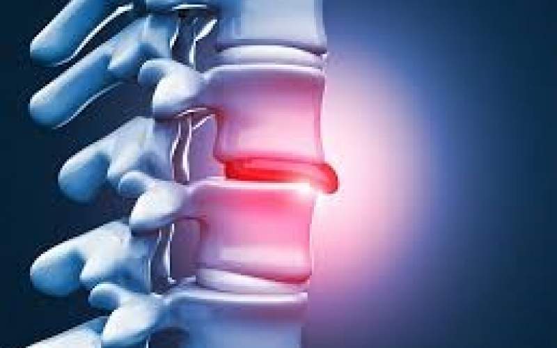 احساس ضعف اندام تحتانی نشانه چیست؟