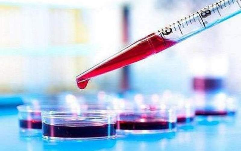تشخیص آلزایمر با یک آزمایش ساده