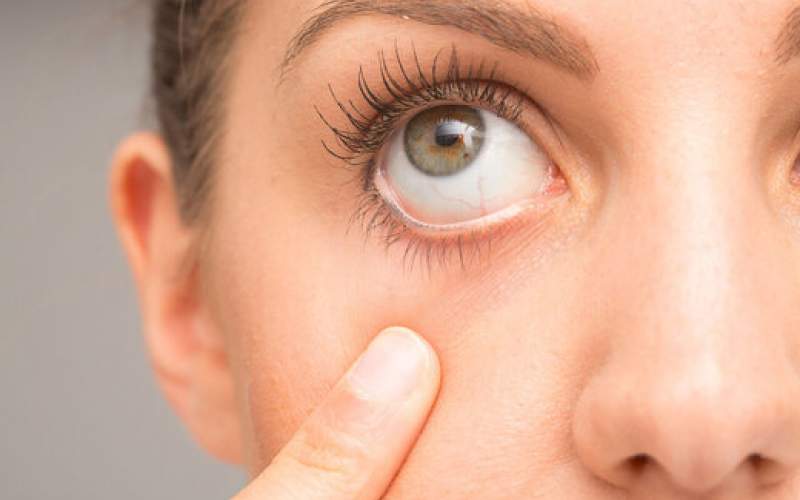 ردگیری کوچک شدن مغز از طریق چشم‌ها