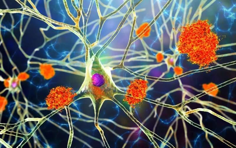 نقش ویروس‌های نهفته در بروز زوال عقل
