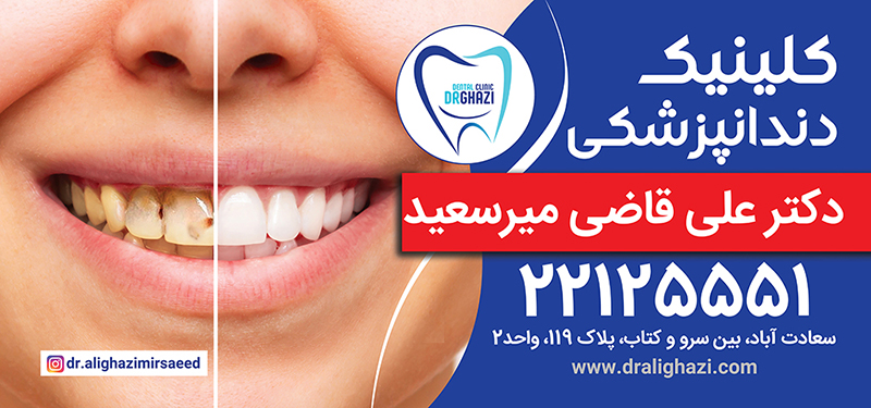 کلینیک دندانپزشکی دکتر قاضی در سعادت آباد