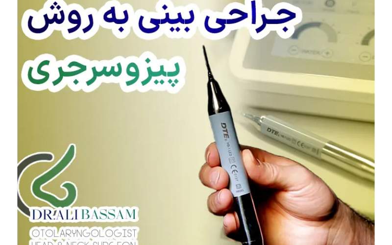 عمل بینی پیزوسرجری چگونه است؟