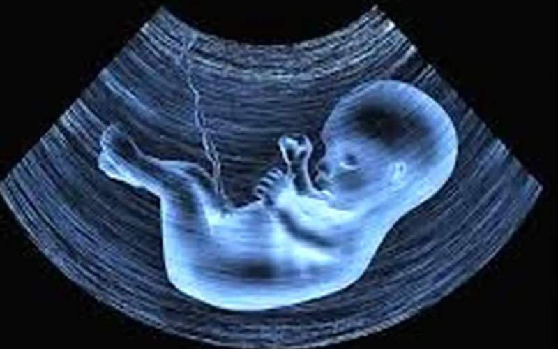 ترکیه مقصد جدید غربالگری جنین