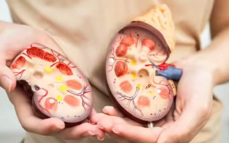 این غذاها کلیه‌ها را زنده نگه می‌دارند