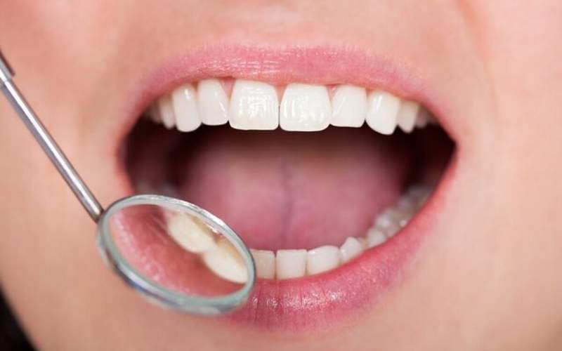 خوراکی‌های مفید برای سلامت دندان