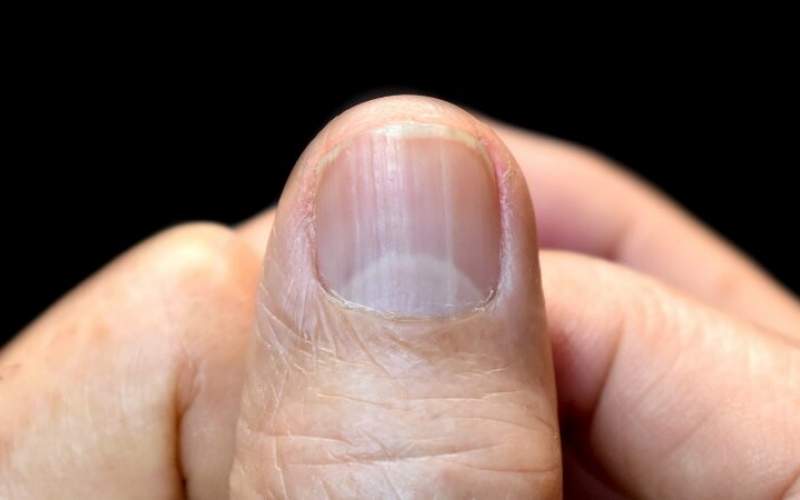 اسراری که هلال ماه ناخن برملا می‌کند