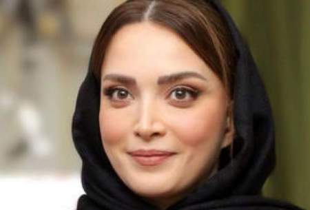 ویدئو زیرخاکی از طباطبایی قبل از عمل زیبایی  