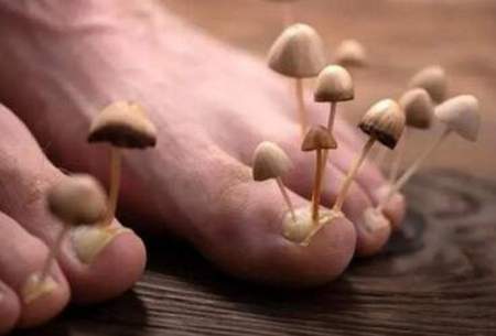 تخم‌مرغ گندیده؛ از بین برنده قارچ‌های ناخن!