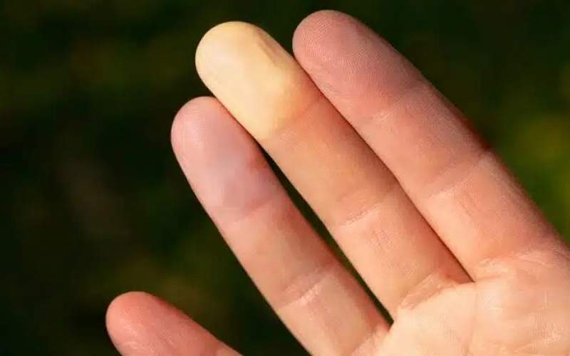 نوک انگشتشما درباره حالروحیتان چه میگوید؟ نوک انگشتشما درباره حالروحیتان چه میگوید؟